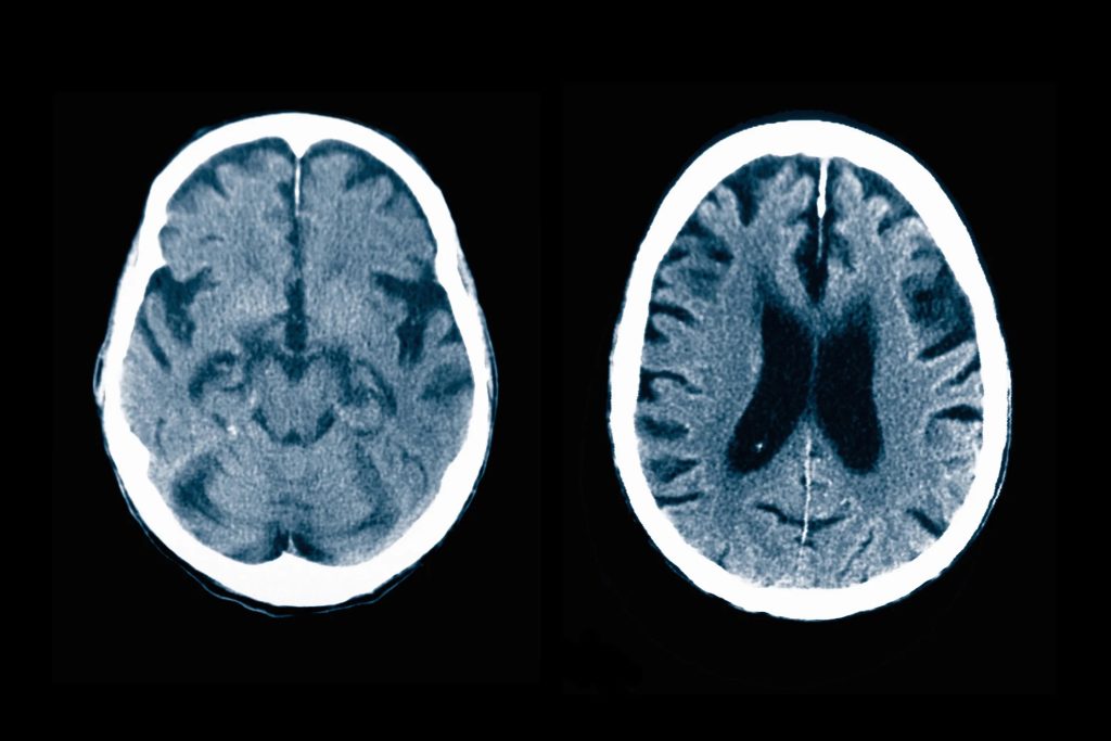 Image or a brain scan